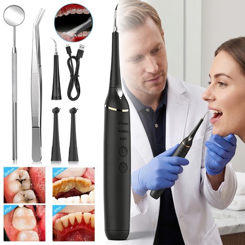 Ultrasonic dental scaler stain - ultrasonic,
