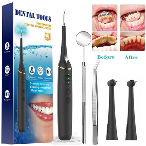 Modes tooth polishing teeth - tooth,
