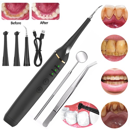 Plaque remover dental cleaning - plaque,
